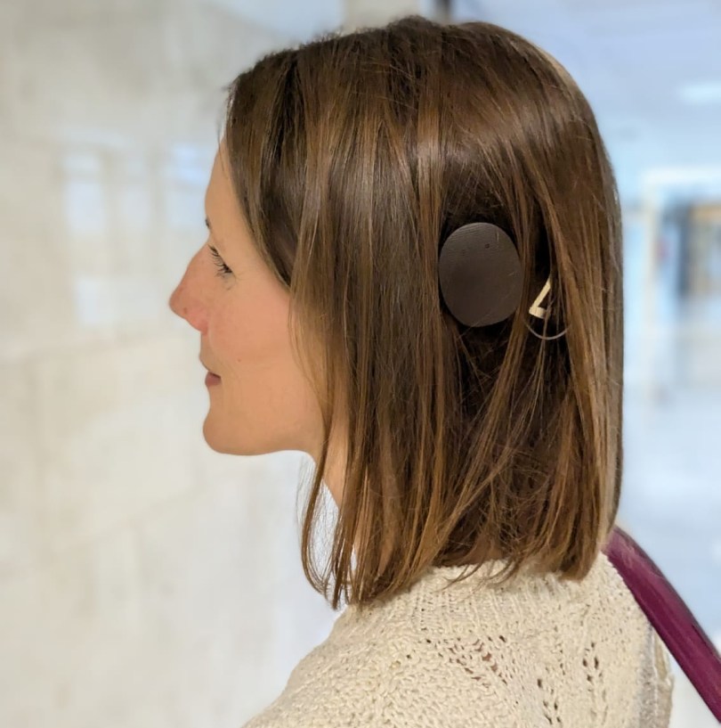 My Cochlear Implant Story: Part 9 – Activation Day – My Hearing Loss Story